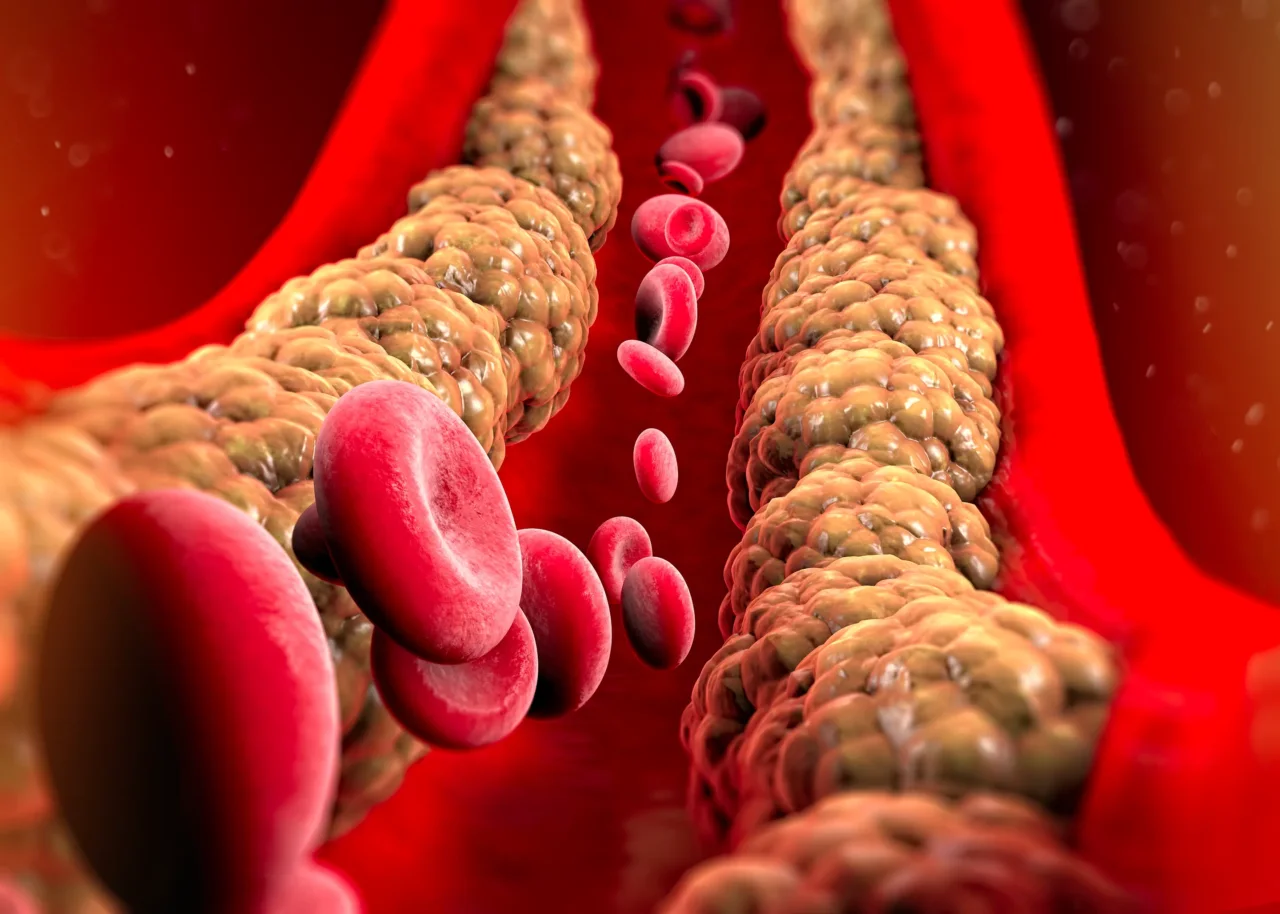 Colesterolo alto: i segnali che spesso trascuriamo secondo il cardiologo Colesterolo alto: i segnali che spesso trascuriamo secondo il cardiologo
